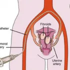 Business 4 image USA FIBROID CENTERS Vascular Surgeons in Bronx NY