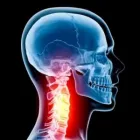 Business 1 image USA HEALTH & PHYSICAL THERAPY Sports Medicine in Oakland Park FL