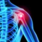 Business 5 image USA HEALTH & PHYSICAL THERAPY Sports Medicine in Oakland Park FL