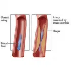 Business 1 image USA VASCULAR CENTERS Surgical Center in Tamarac FL