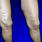Business 1 image USA VEIN CLINICS Vein Doctor in New York NY
