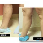 Business 3 image USA VEIN CLINICS Vein Doctor in New York NY