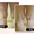 Business 3 image USA VEIN CLINICS Vein Doctor in Brooklyn NY