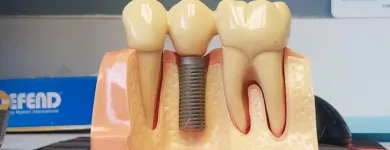 Business 7 image AA SOUTH FLORIDA DENTISTRY General Dentists in Miami FL