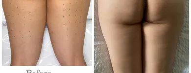 Business 4 image AGUILAR AESTHETICS - MED SPA Wellness Center in Oakland Park FL