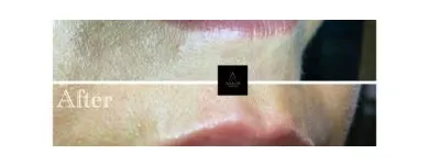 Business 5 image AGUILAR AESTHETICS - MED SPA Wellness Center in Oakland Park FL