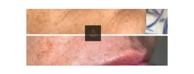 Business 6 image AGUILAR AESTHETICS - MED SPA Wellness Center in Oakland Park FL