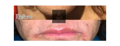 Business 9 image AGUILAR AESTHETICS - MED SPA Wellness Center in Oakland Park FL