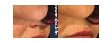 Business 10 image AGUILAR AESTHETICS - MED SPA Wellness Center in Oakland Park FL
