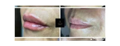 Business 11 image AGUILAR AESTHETICS - MED SPA Wellness Center in Oakland Park FL