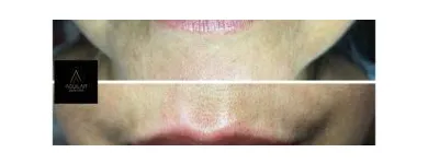 Business 12 image AGUILAR AESTHETICS - MED SPA Wellness Center in Oakland Park FL