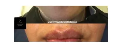 Business 13 image AGUILAR AESTHETICS - MED SPA Wellness Center in Oakland Park FL