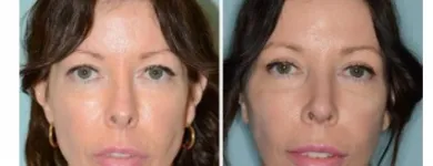 Business 2 image DR. ANTHONY BARED, M.D - FACIAL PLASTIC SURGEON Plastic Surgeons in Maimi FL