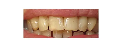 Business 3 image EMERGENCY DENTAL SERVICE ORLANDO, FL 32806 Implant Dentistry in Orlando FL