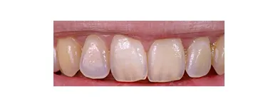 Business 1 image EMERGENCY DENTAL SERVICE ORLANDO, FL 32806 Implant Dentistry in Orlando FL