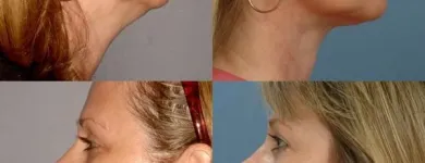 Business 2 image ERNESTO J RUAS MD FACS Tummy Tuck in Tampa FL