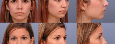 Business 6 image ERNESTO J RUAS MD FACS Tummy Tuck in Tampa FL