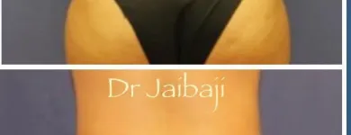 Business 4 image JAIBAJI PLASTIC SURGERY in San Diego CA