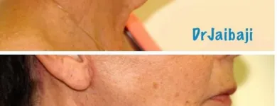 Business 8 image JAIBAJI PLASTIC SURGERY in San Diego CA