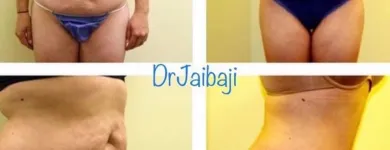 Business 10 image JAIBAJI PLASTIC SURGERY in San Diego CA