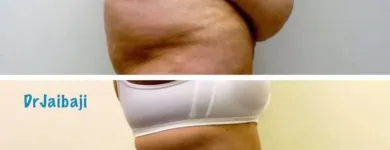 Business 11 image JAIBAJI PLASTIC SURGERY in San Diego CA