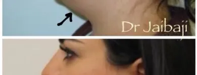 Business 12 image JAIBAJI PLASTIC SURGERY in San Diego CA