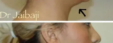 Business 15 image JAIBAJI PLASTIC SURGERY in San Diego CA