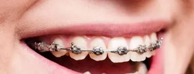 Business 11 image JOHN P. GOODMAN DDS Invisalign in Kansas City MO