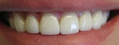 Business 17 image JOHN P. GOODMAN DDS Invisalign in Kansas City MO