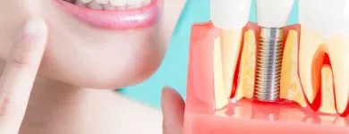 Business 5 image LA MESA DENTAL SERVICES General Dentist in San Diego CA