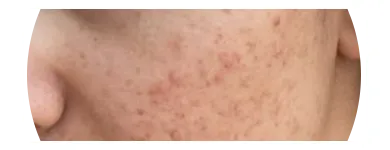 Business 3 image PERFECT SKIN Beauty Products in Orlando FL