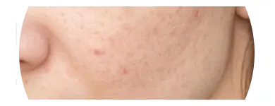 Business 4 image PERFECT SKIN Beauty Products in Orlando FL