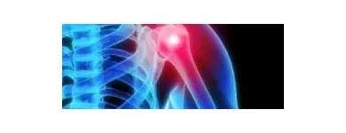 Business 5 image USA HEALTH & PHYSICAL THERAPY Sports Medicine in Oakland Park FL