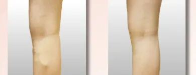 Business 4 image USA VEIN CLINICS Vein Doctor in New York NY