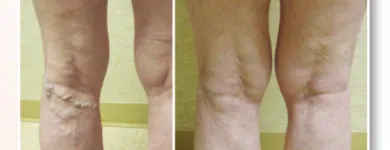 Business 2 image USA VEIN CLINICS Vein Doctor in New York NY