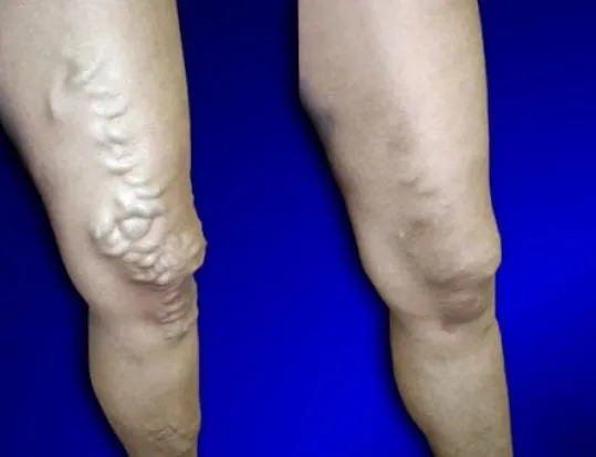Business 1 image USA VEIN CLINICS