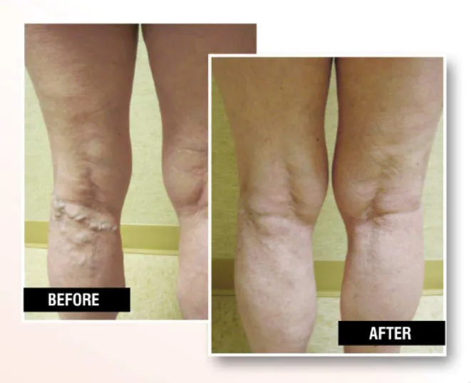 Business 1 image USA VEIN CLINICS