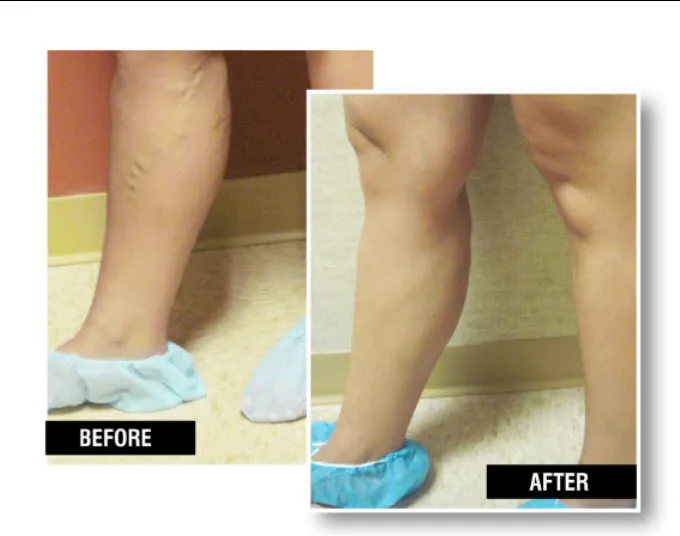 Business 1 image USA VEIN CLINICS