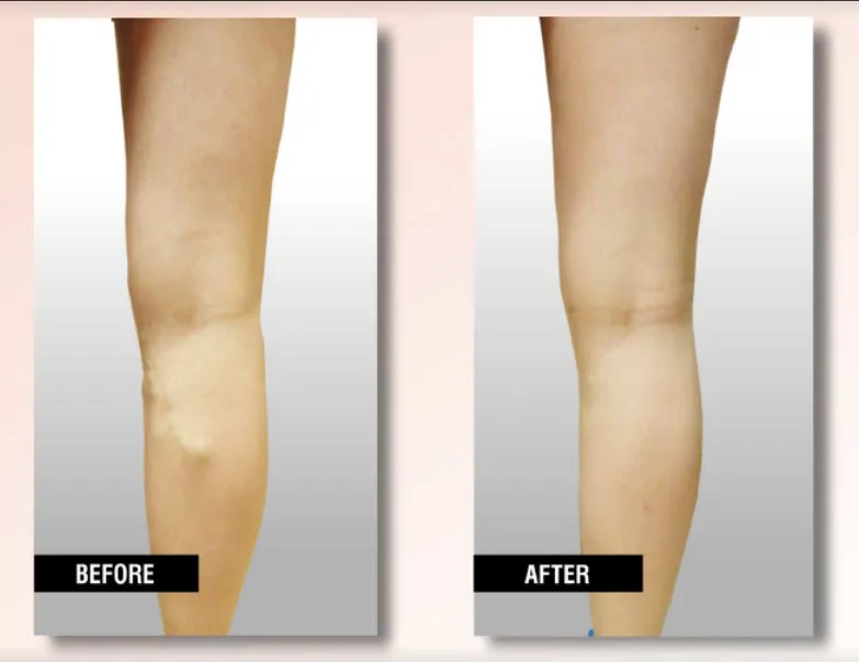 Business 4 image USA VEIN CLINICS